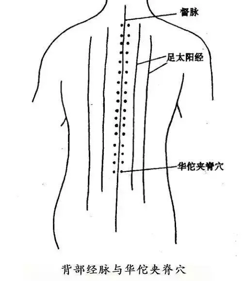遇冷後發生的腰痛,中醫治療簡單還省錢
