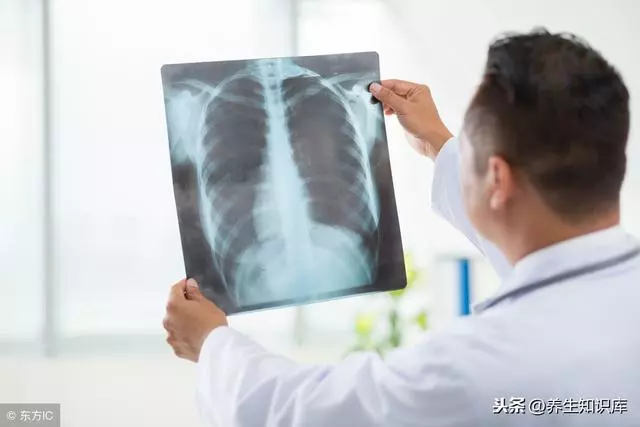 肺癌多是「拖」出來的,出現4種跡象,趁早就醫,尤其是這三類人