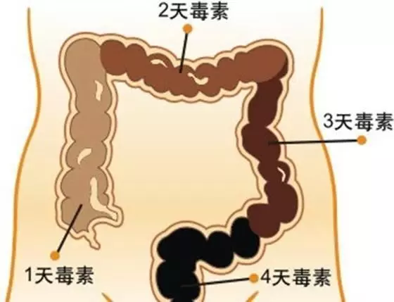 經常放屁不一定是在排毒,可能跟4種疾病有關,別不當回事