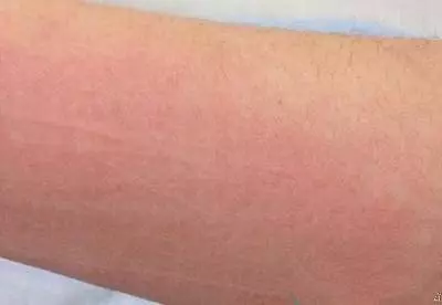 睡覺時,有這種表現就是中風前兆!一定要警惕哦!
