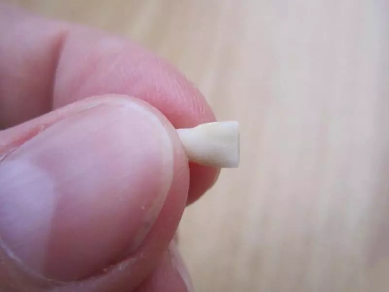 別再把「小孩掉落的乳牙」扔掉了!最新研究證明:關鍵時刻可救自己一命!