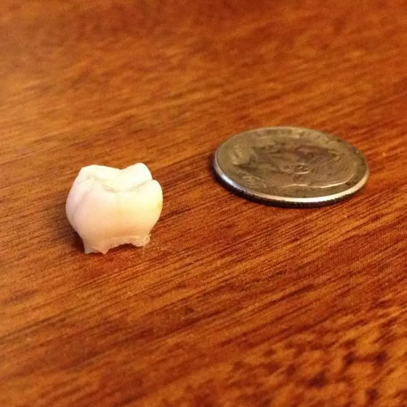 別再把「小孩掉落的乳牙」扔掉了!最新研究證明:關鍵時刻可救自己一命!