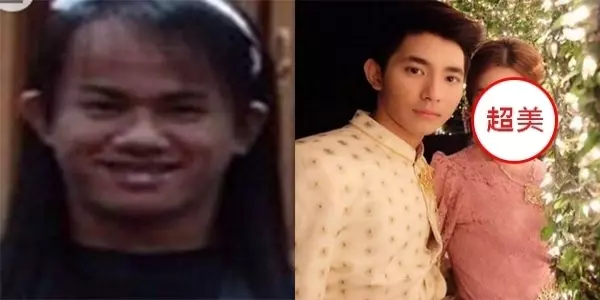 32歲泰國人妖花巨資變性被嫌醜!她怒整容馬上變「女神」,嫁21歲超帥有錢富二代為妻!