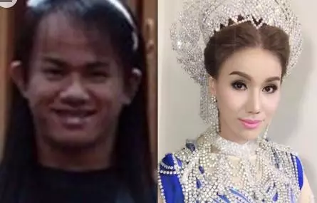 32歲泰國人妖花巨資變性被嫌醜!她怒整容馬上變「女神」,嫁21歲超帥有錢富二代為妻!