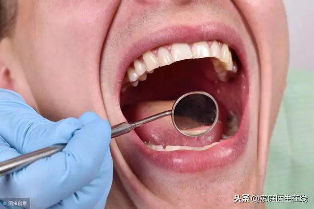 牙齒那麼多顆,缺一個沒關係?醫生細數缺牙隱患!