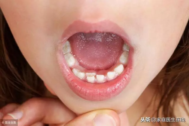 牙齒那麼多顆,缺一個沒關係?醫生細數缺牙隱患!