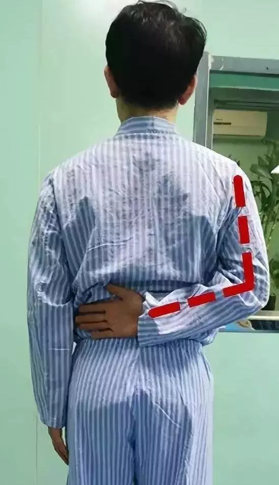 肩關節疼?做以下幾個動作,有效緩解疼痛!