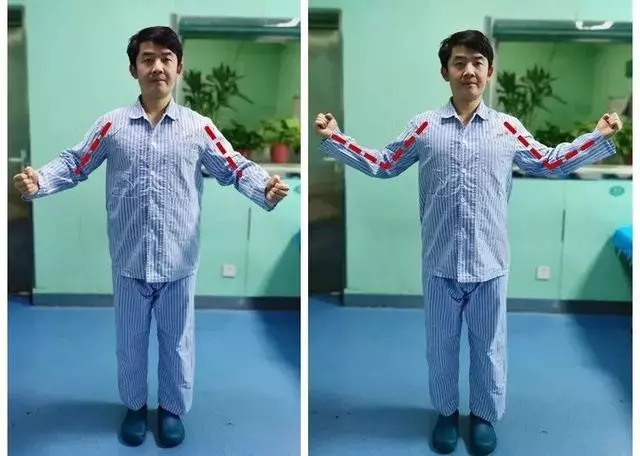 肩關節疼?做以下幾個動作,有效緩解疼痛!