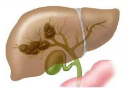 不想洗腎就別亂吃哦!記得做到「飯後 1 不要」、「睡前 2 不要」!