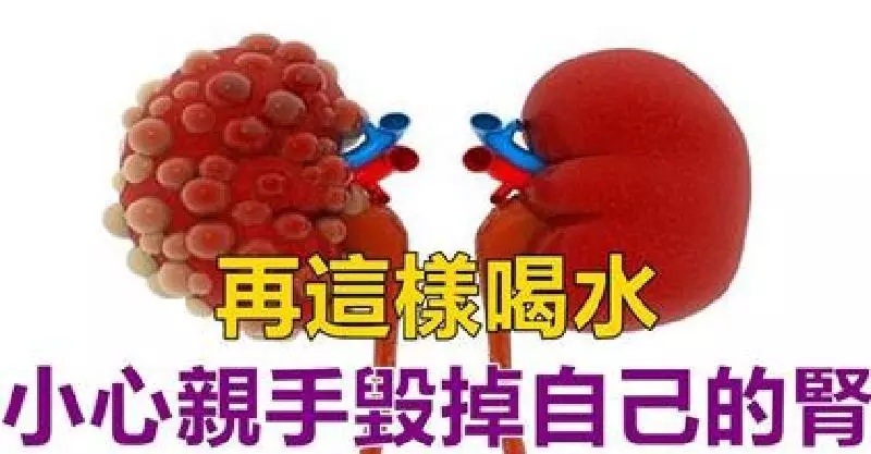 再這樣喝水,小心親手毀掉自己的腎,喝水有「3不12要」,做對遠離醫生,腎病不來擾