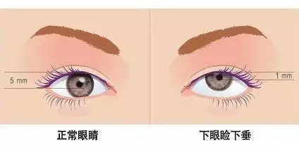 眼睛「乾乾」的,別以為是小事....大病來臨前,身體給你14個預兆!!再不注意來不及了