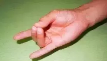 太神奇了!把三個手指放到一起,竟然能補腎 排毒 明目 防心梗