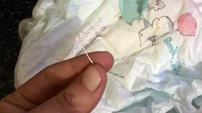 嬰兒紙尿布竟藏針 2歲童大腿慘遭刮傷