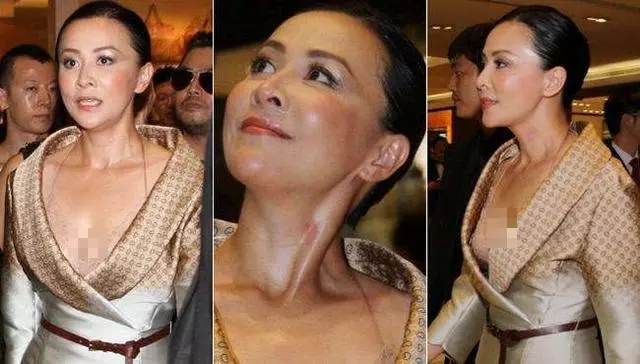 激情過度「留吻痕」的6位女星,而最後一個未婚也有?太尷尬……
