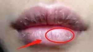 肝不舒服,身體有3種表現,常喝1種水,吸走肝臟毒素,肝臟更健康