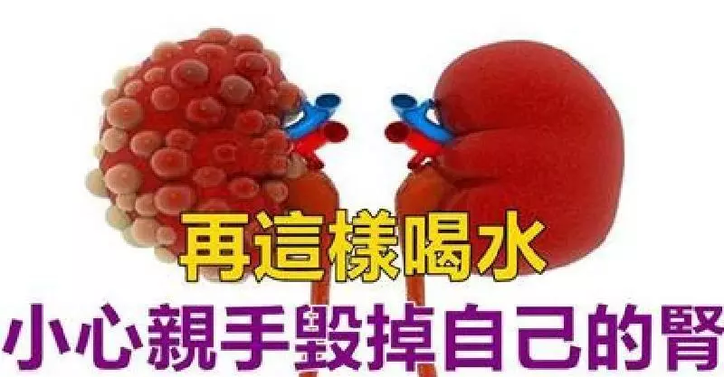 再這樣喝水,小心親手毀掉自己的腎,喝水有「3不12要」,做對遠離醫生,腎病不來擾