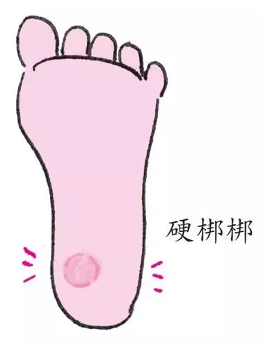 頭痛、氣喘、腿抽筋,按這些穴位一分鐘見效,常按養生保健康