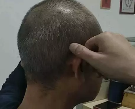 邊捏耳朵邊扭腰，能幫助修復受傷的腰，對腰痛、勞損、發涼都好