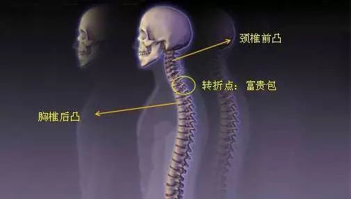脖子上的【富 貴 包】越長越大?教你3個小動作【自我治療】,富貴包慢慢變小!