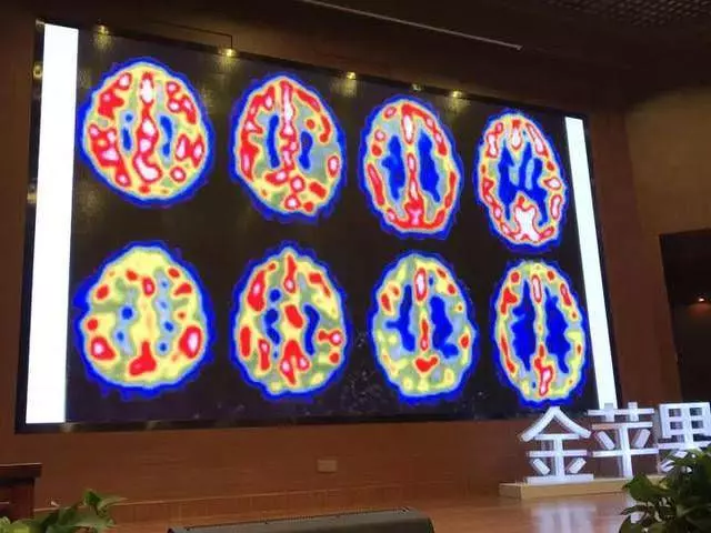 (腦科教授)腦科學家洪蘭教授為你揭秘:發展孩子大腦最好的3個方法,讓孩子更聰明