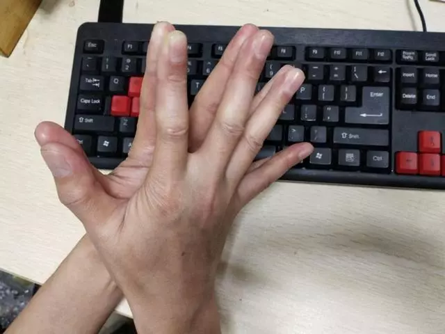 鼓掌也能排毒,每天拍手2分鐘,排出身體的毒素,對身體非常好