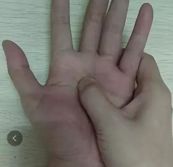手上有一個降血壓穴,每天按6分鐘,穩定血壓,爬樓梯也不氣喘了