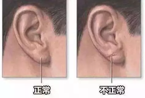 身體是否健康,看看面部就知道中醫教你30秒自測