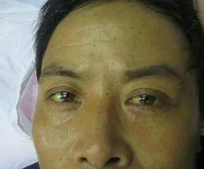 身體是否健康,看看面部就知道中醫教你30秒自測