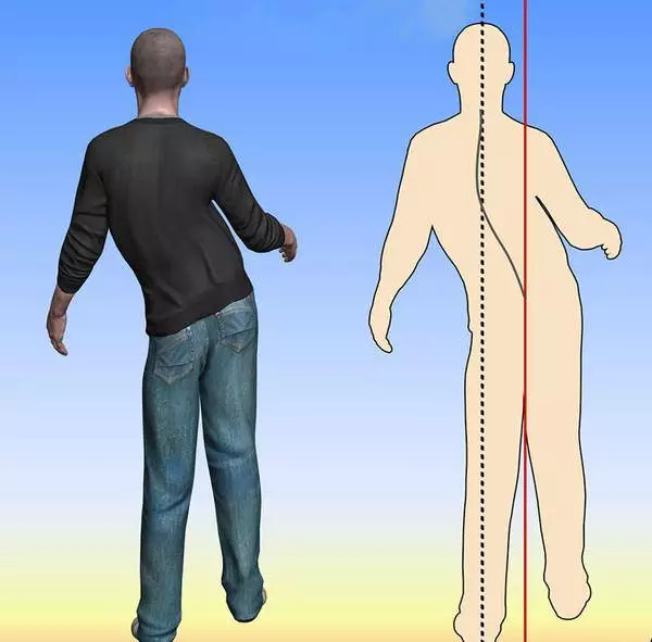 45歲後,血管越來越堵,記住「3勤4挑」,助你清血管,消百病!