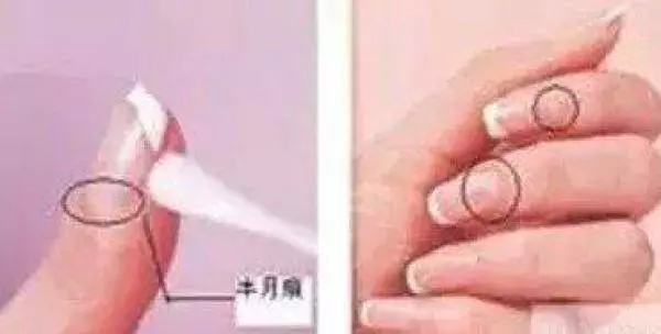 從手指甲就可以看出一個人的健康!你知道指甲上一條一條的橫紋縱紋代表什麼意思嗎?