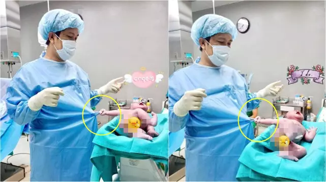 剛出生幾秒鐘的嬰兒拉住醫生手術服不撒手,照片發布後萌翻網友:瞧這暴脾氣