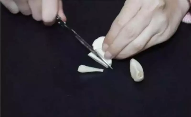 晚上經常失眠多夢?奶奶教我這一招,讓你一覺睡到大天亮!失眠的人試試試看