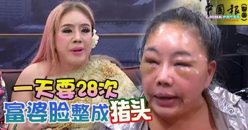一天要28次-富婆臉整成豬頭