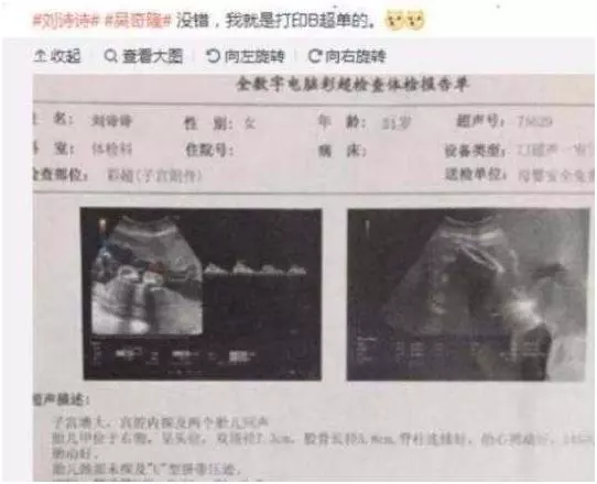 劉詩詩與公婆低調現身做產檢,B超照不慎流出?吳奇隆:兩個寶寶!