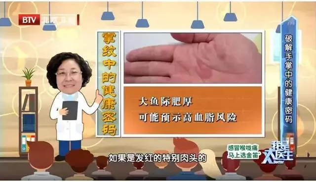 心腦血管好不好?看手知道!醫生提醒:5個地方長青筋,要注意了