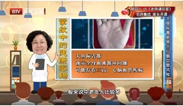 心腦血管好不好?看手知道!醫生提醒:5個地方長青筋,要注意了
