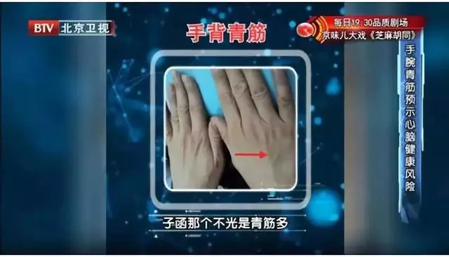 心腦血管好不好?看手知道!醫生提醒:5個地方長青筋,要注意了