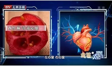 心腦血管好不好?看手知道!醫生提醒:5個地方長青筋,要注意了