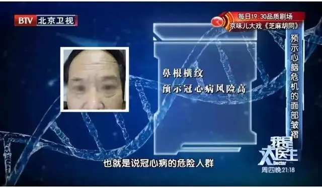心腦血管好不好?看手知道!醫生提醒:5個地方長青筋,要注意了