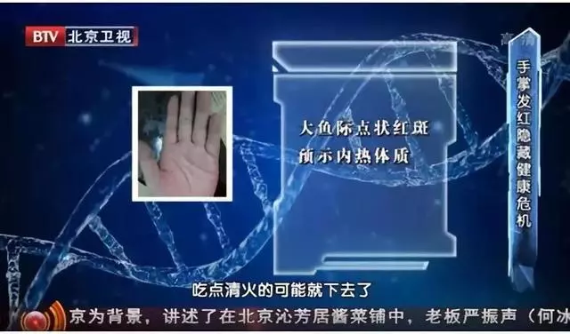 心腦血管好不好?看手知道!醫生提醒:5個地方長青筋,要注意了