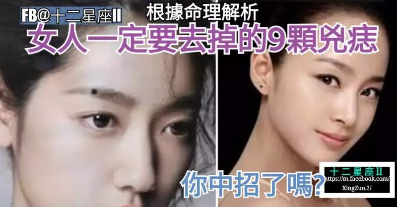 【根據命理解析】女人一定要去掉的9顆兇痣,你中招了嗎?
