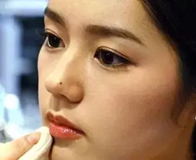 【根據命理解析】女人一定要去掉的9顆兇痣,你中招了嗎?
