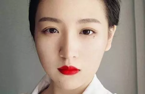 【根據命理解析】女人一定要去掉的9顆兇痣,你中招了嗎?