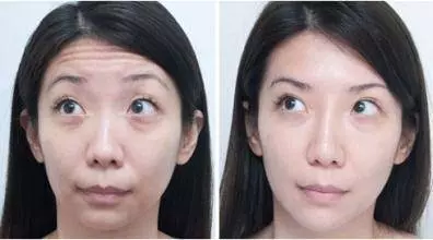 教你一個去皺新方法,很多大姐都在用,非常管用還省錢!
