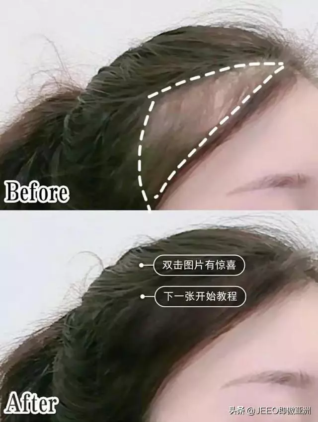 每日一招——早晚5分鐘生髮防脫髮