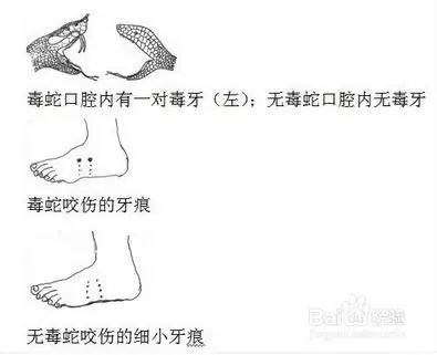 真人真事!他好心放生蛇反遭蛇咬一口,原來是蛇竟然是想要救他!