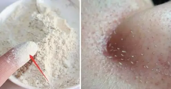 很多人不知道皮膚這樣就是有「蟎蟲」,教你一招,皮膚變好、整個人更美了。