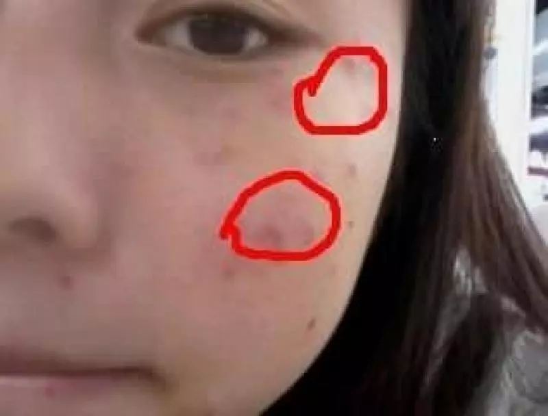 很多人不知道皮膚這樣就是有「蟎蟲」,教你一招,皮膚變好、整個人更美了。