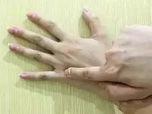 人體自帶消炎、解氣、排毒閥,不花錢不求人,不看太虧了