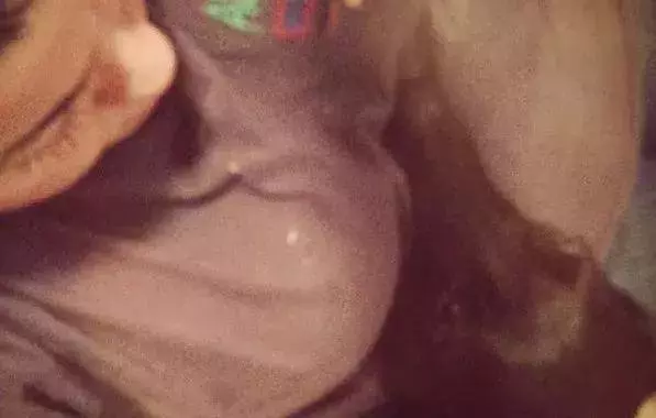 領養的狗狗老喜歡趴在主人肚子上,去醫院一查才驚喜的發現 !